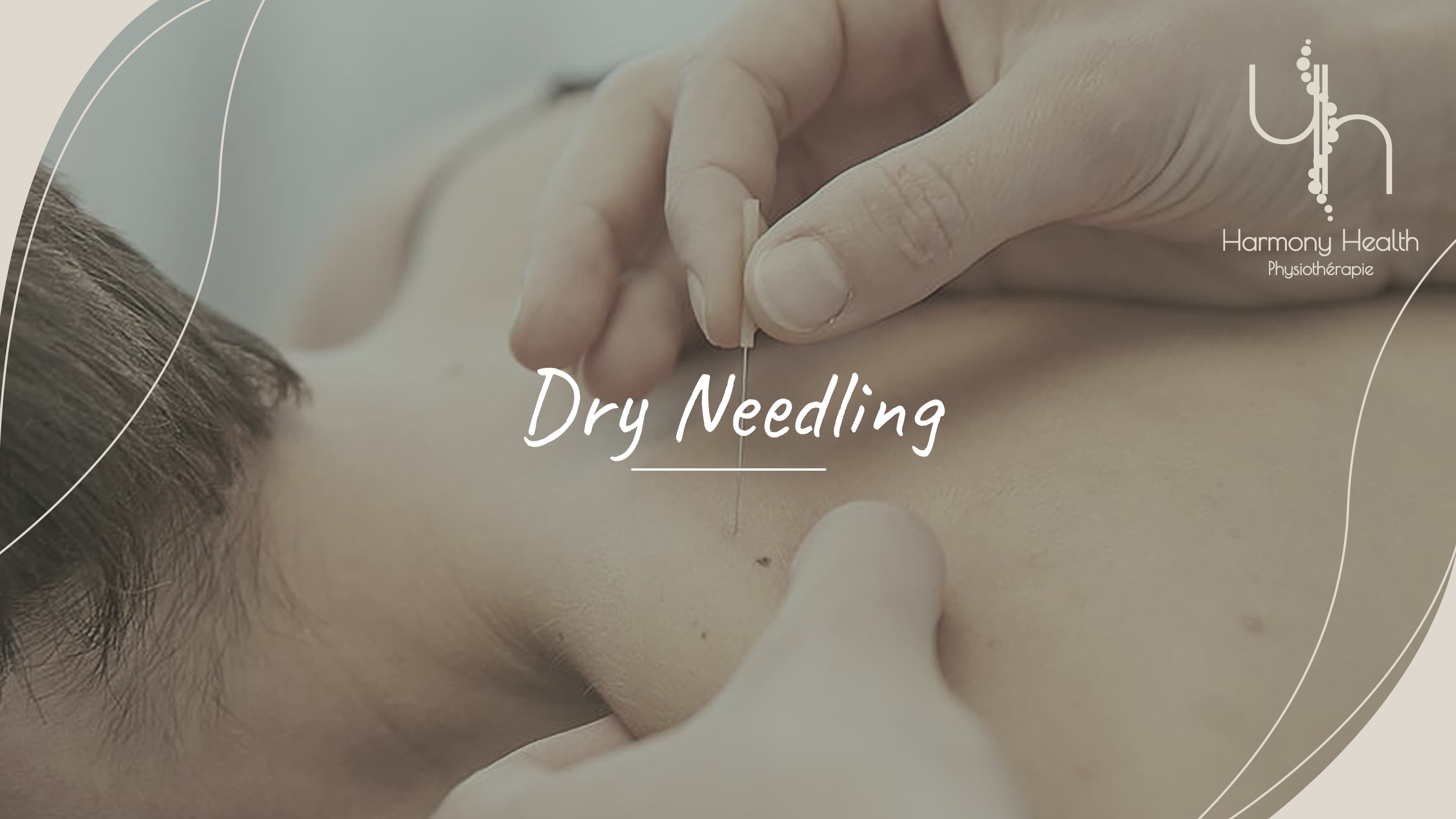 Dry Needling à Tanger
